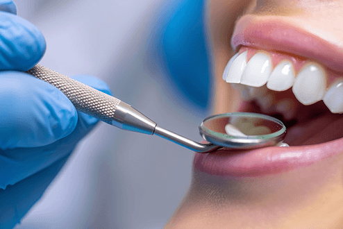 Signs You Might Need a Dental Filling: Don’t Ignore These Symptoms