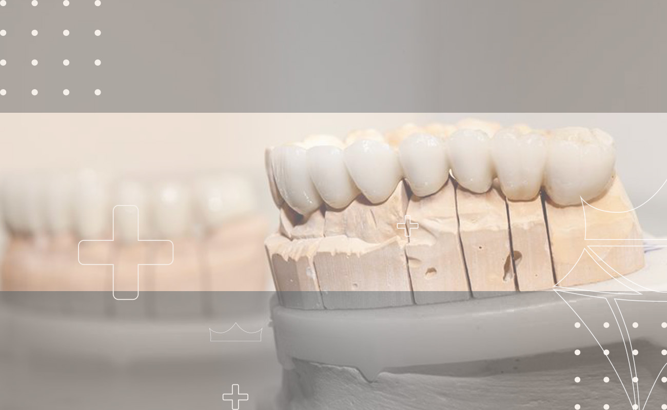 SaphireDent-FullMouth-Reconstruction