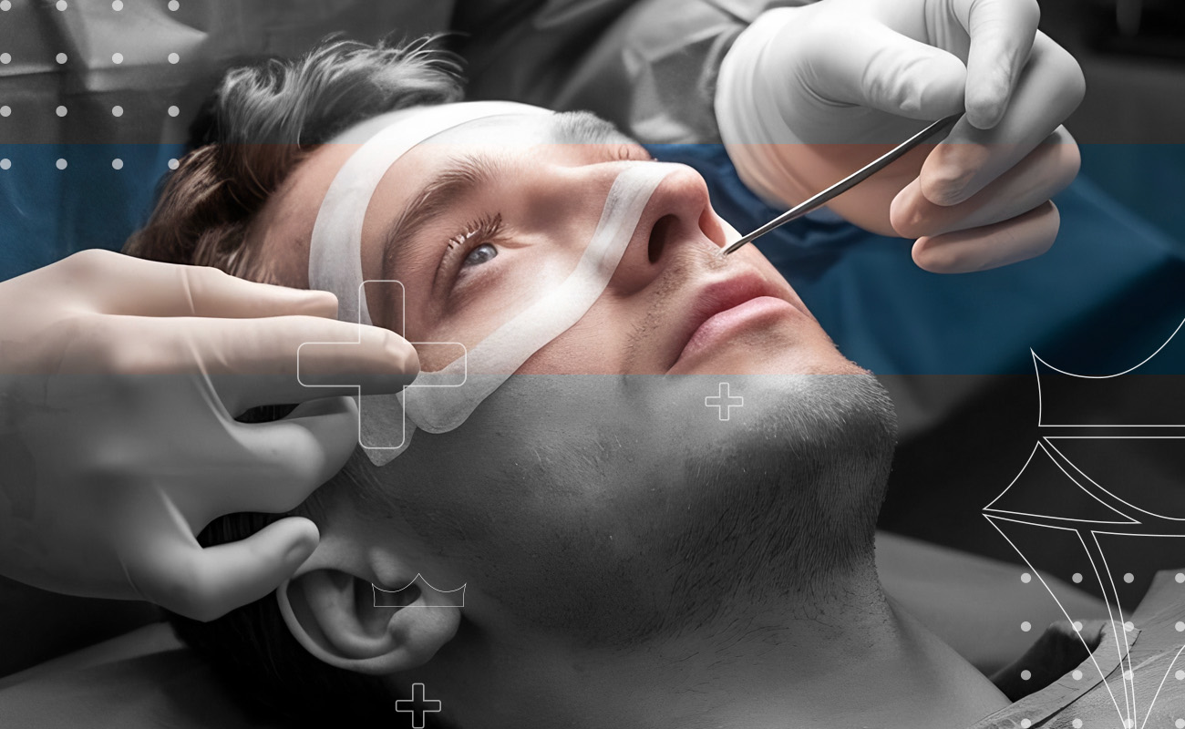 SaphireDent-Sinus-Lift-Surgery-01