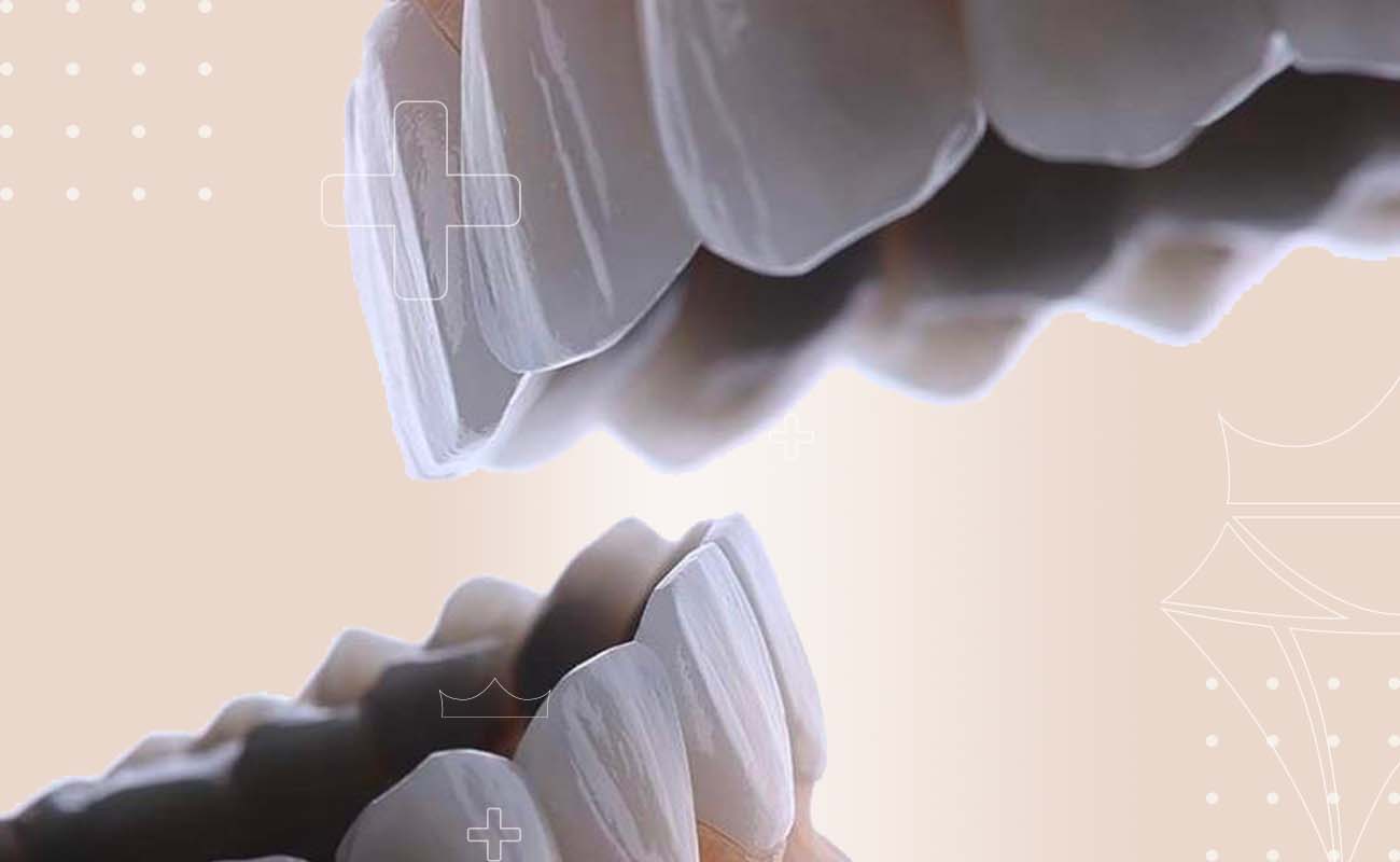 SaphireDent-DentalBridges