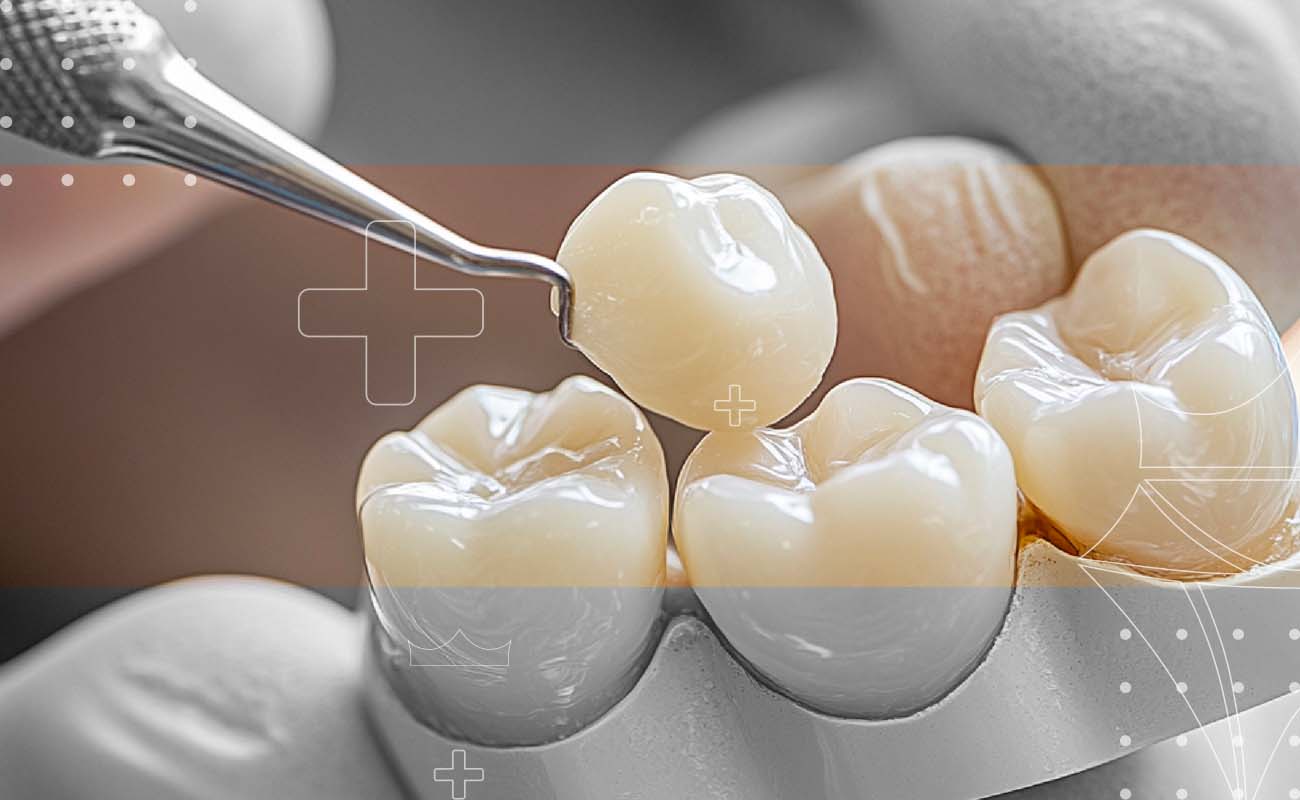 saphiredent-dentalsealants