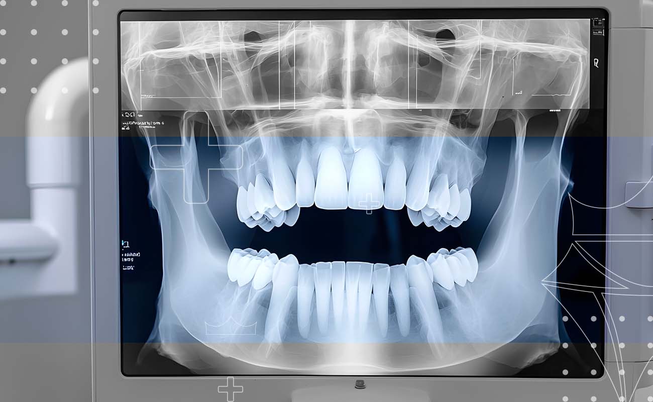 SaphireDent-Oral-Examination&-DigitalXray