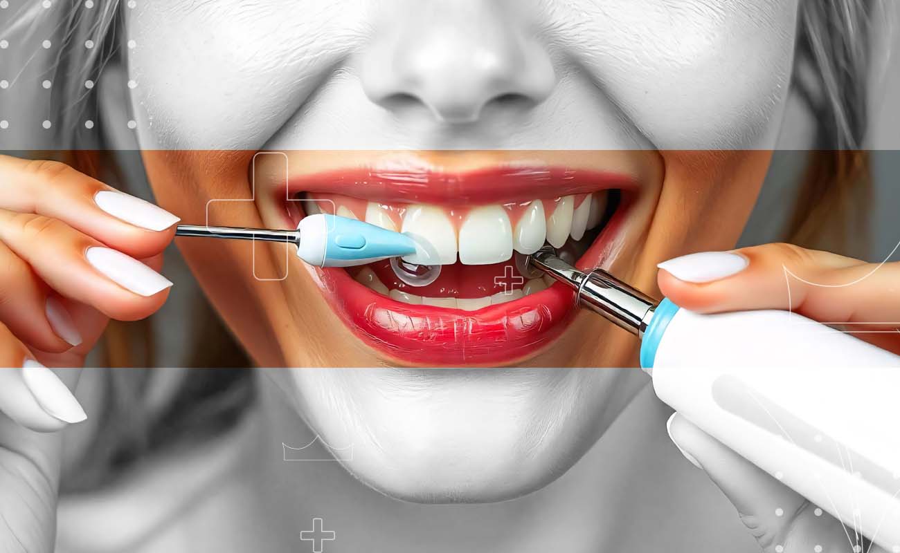 SaphireDent-Professional-Teeth-Cleaning