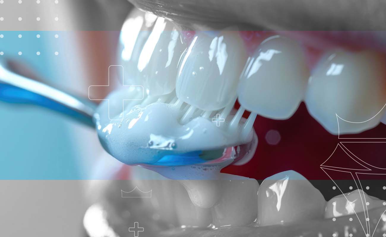 SaphireDent-Tooth-Colored-Fillings-01