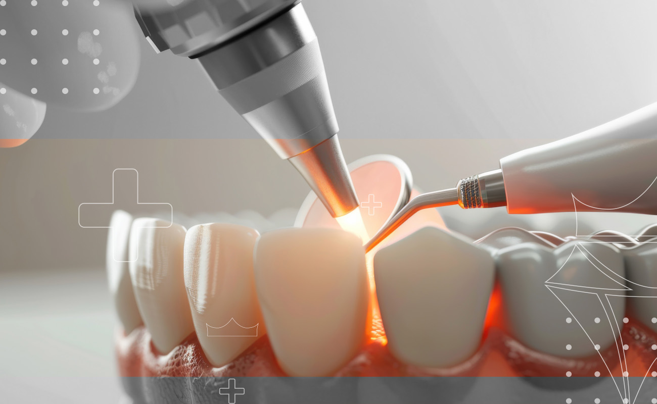 SaphireDent-Laser-assistedRootCanal-2
