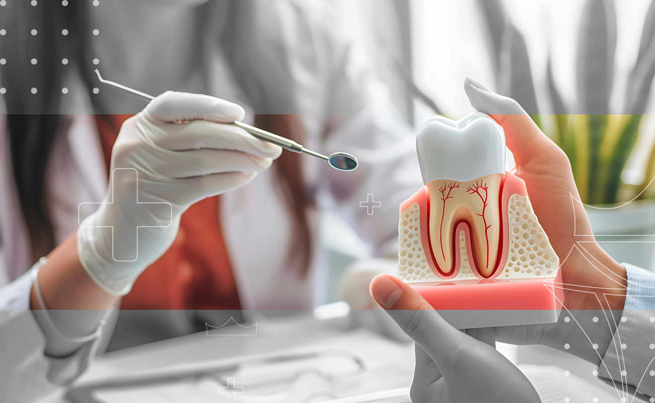 SaphireDent-Root-Canal