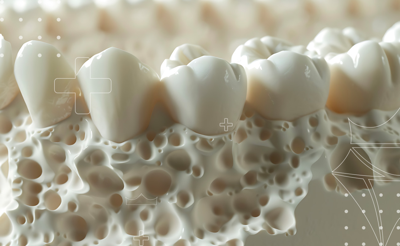 SaphireDent-Bone-Regeneration-02