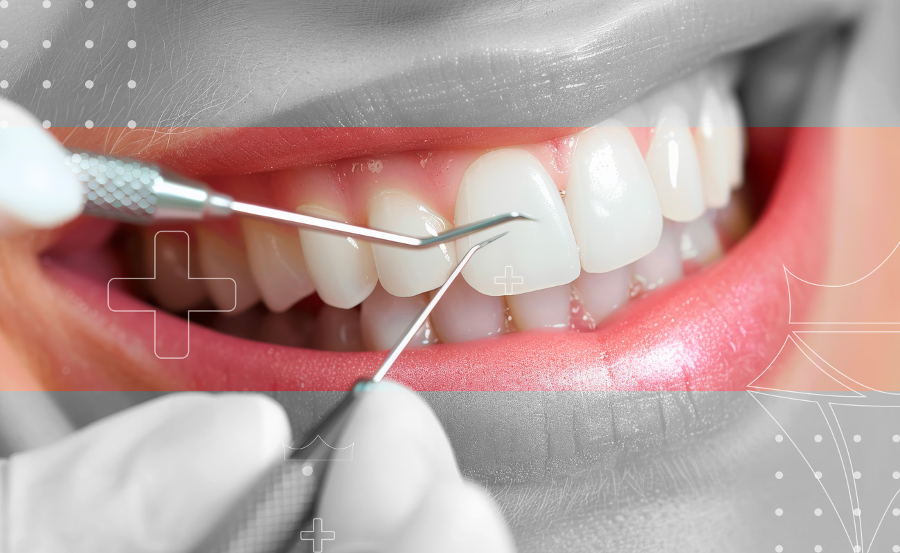 SaphireDent-DeepCleaning-01