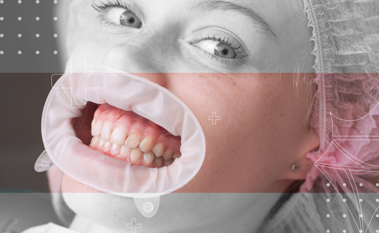 SaphireDent-DeepCleaning-04