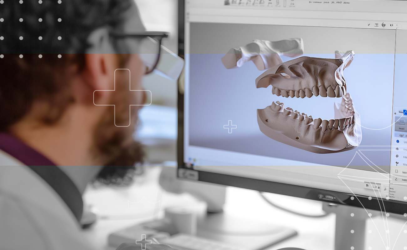 SaphireDent-CADCAM-Prosthesis-Design