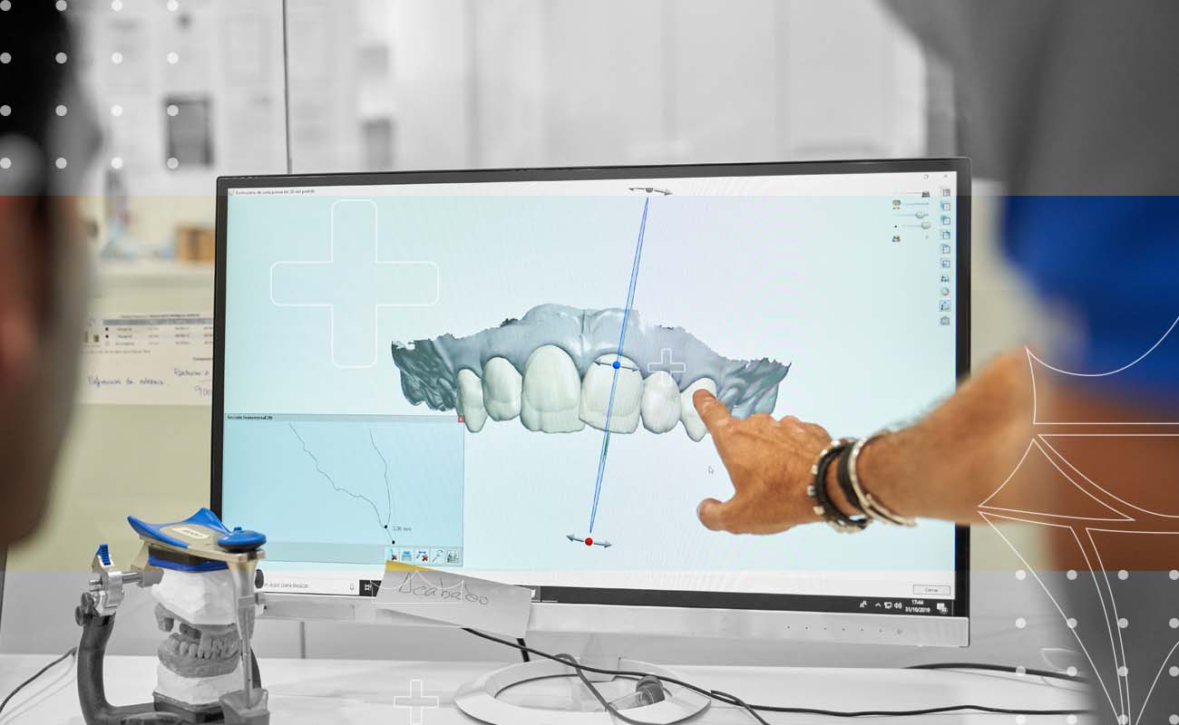 SaphireDent-Digital-Smile-Design